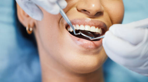 Best Emergency Wisdom Teeth Removal in Holualoa, HI